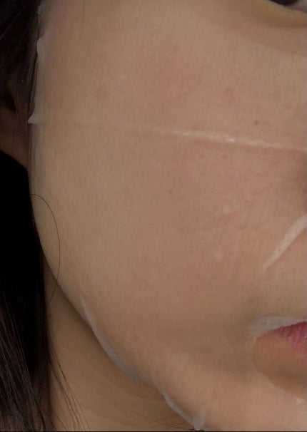 ドクダミシートマスクデイリーピック/Abib /シートマスク・パックを使ったクチコミ(2枚目)