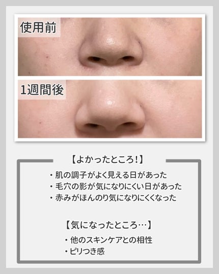 リードルショット100/VT/美容液を使ったクチコミ(4枚目)