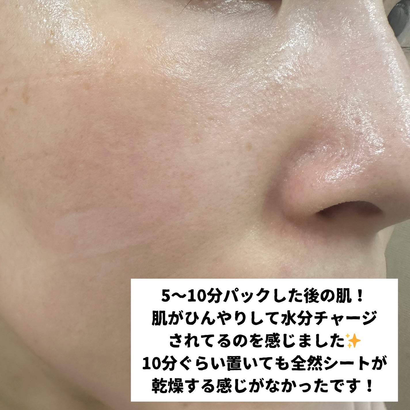 ルルルンプレシャス GREEN(Glow Up)/ルルルン/シートマスク・パックを使ったクチコミ(5枚目)