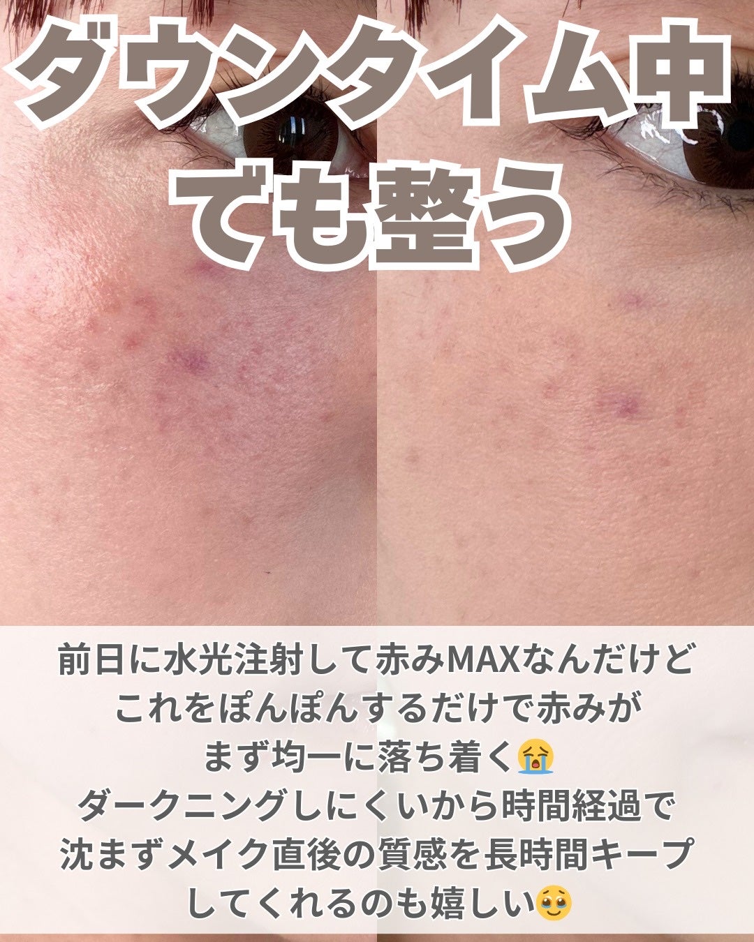 キル カバー ファンウェア クッション/CLIO/クッションファンデーションを使ったクチコミ(3枚目)