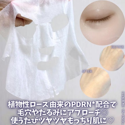 PDRN リフティングマスク/MEDIHEAL/シートマスク・パックを使ったクチコミ(5枚目)