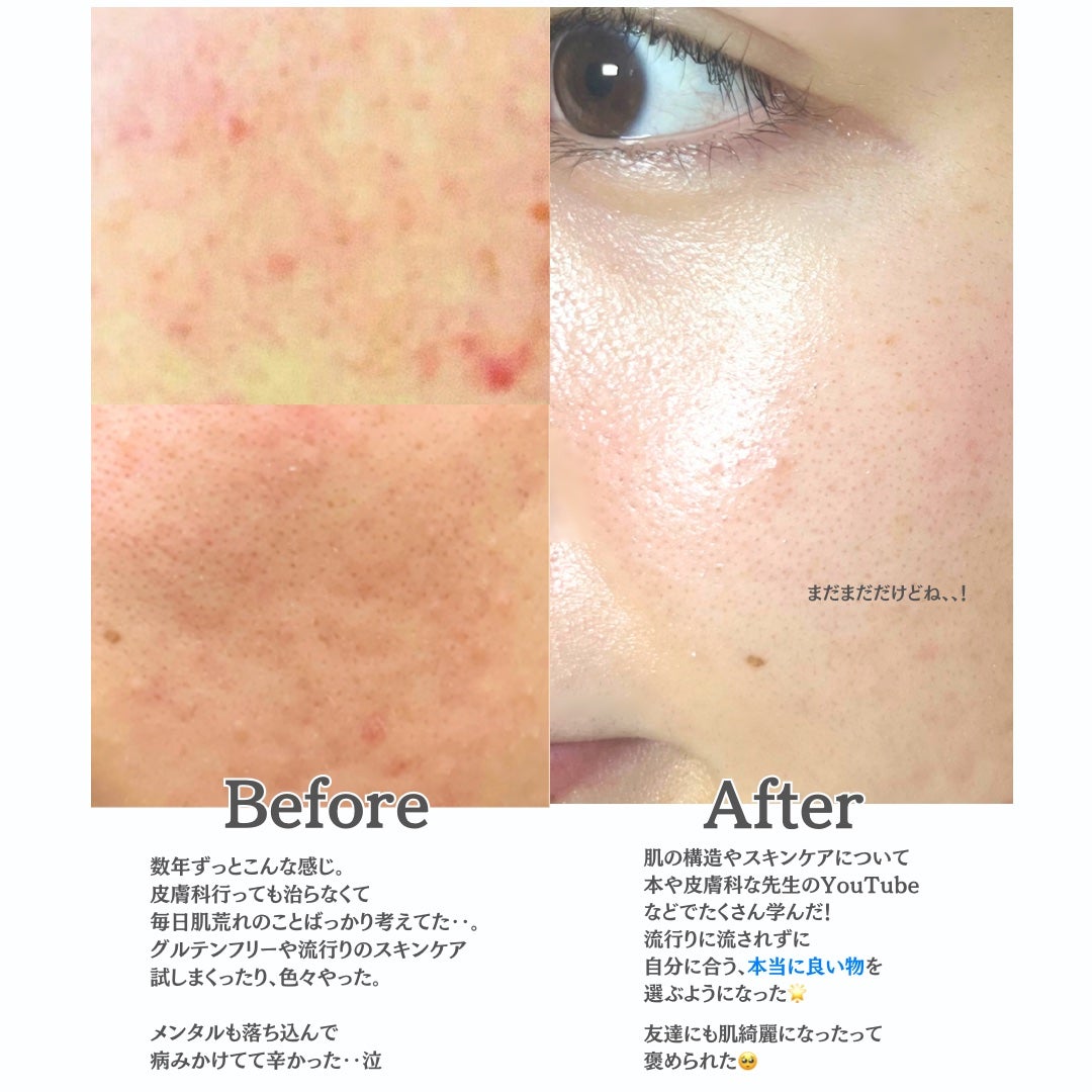 バランシングフェイスオイル ラベンダー/ゼラニウム/MARKS&WEB/ブースター・導入液を使ったクチコミ(2枚目)