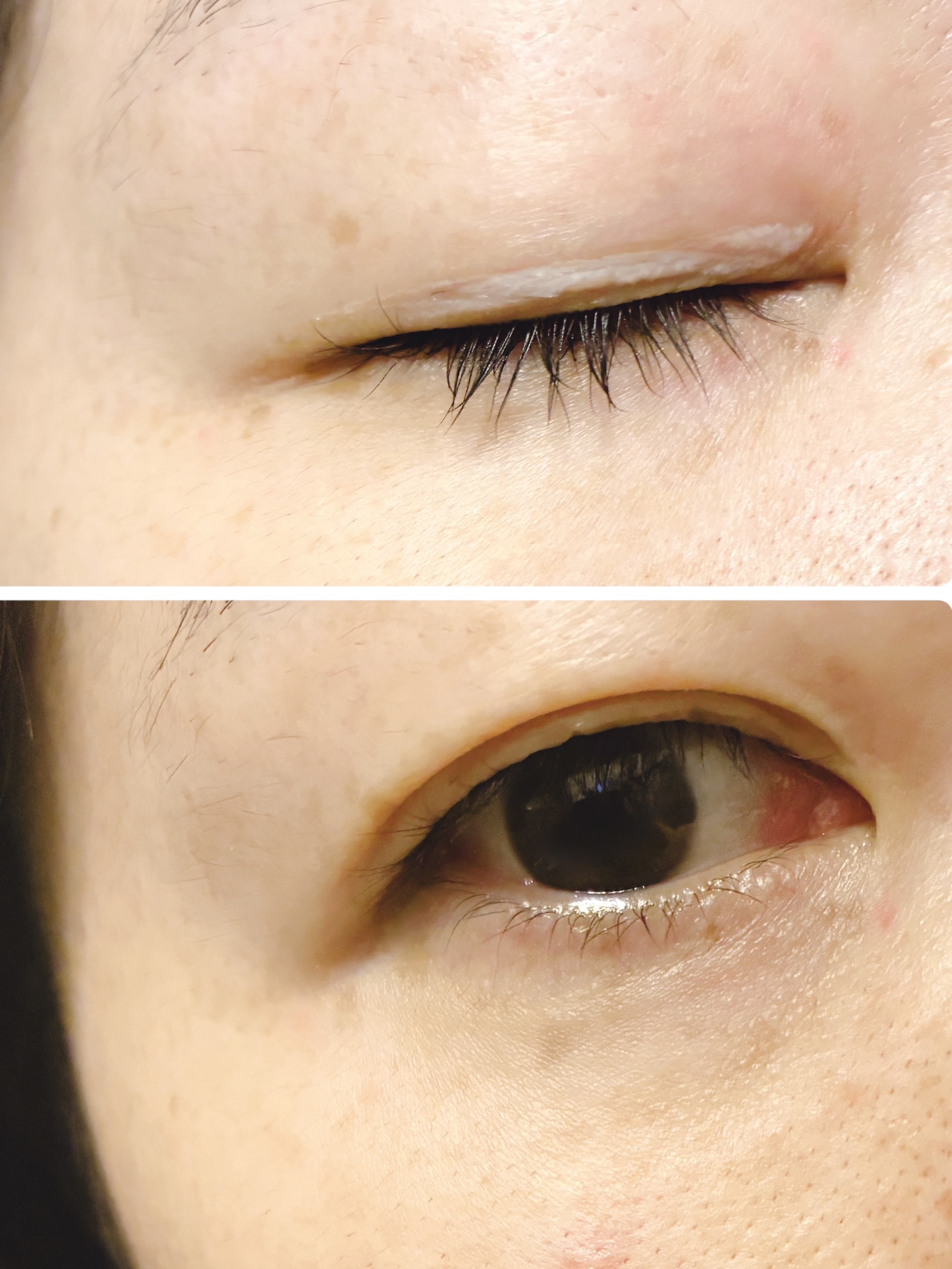 オリシキ アイリッドスキンフィルム EX/D-UP/二重まぶた用アイテムを使ったクチコミ（3枚目）