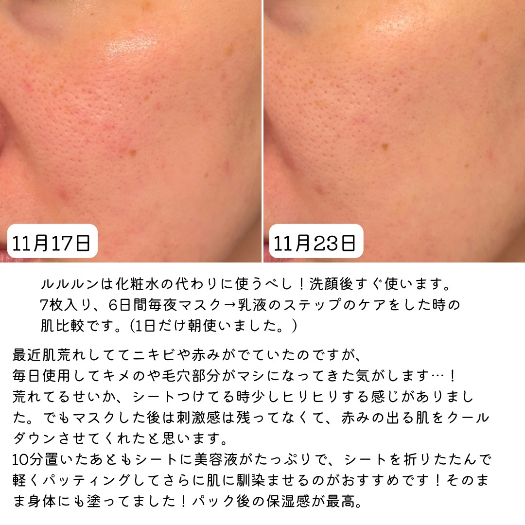 ルルルンプレシャス GREEN（Glow Up）/ルルルン/シートマスク・パックを使ったクチコミ（3枚目）