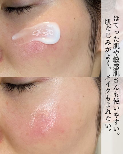 レッドブレミッシュ クリアスージングクリーム/Dr.G/フェイスクリームを使ったクチコミ(5枚目)