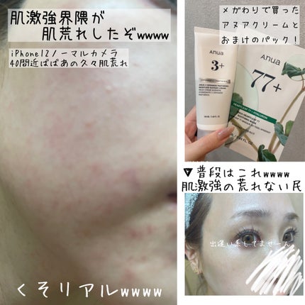 ドクダミ77 % 鎮静マスクパック/Anua/シートマスク・パックを使ったクチコミ(7枚目)