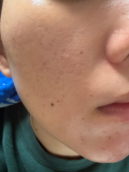 を使ったクチコミ(1枚目)