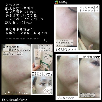 ドクダミ77 % 鎮静マスクパック/Anua/シートマスク・パックを使ったクチコミ(6枚目)