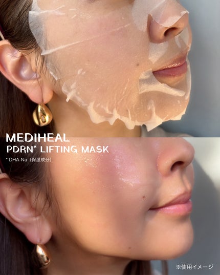 PDRN リフティングパッド/MEDIHEAL/トナーパッドを使ったクチコミ(3枚目)