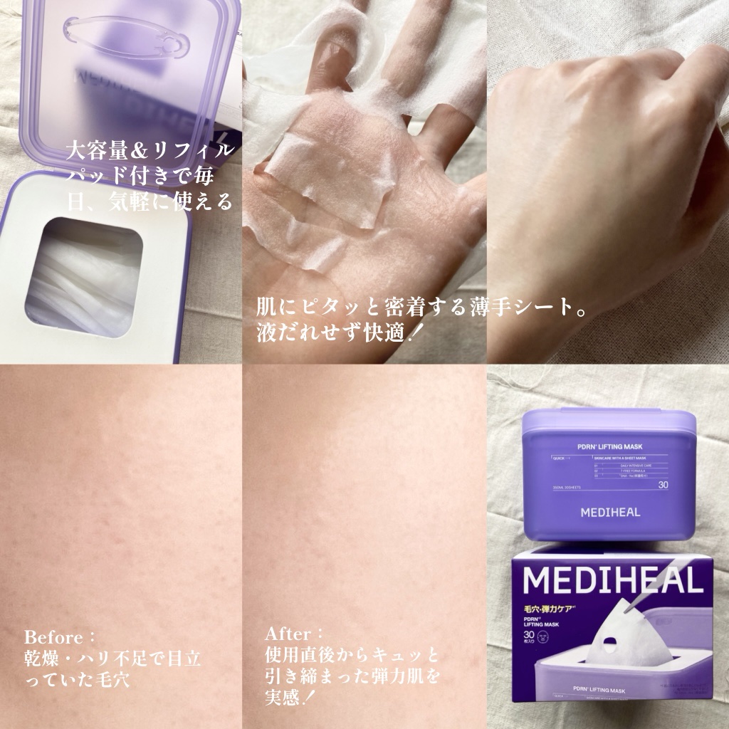 PDRN リフティングマスク/MEDIHEAL/シートマスク・パックを使ったクチコミ（2枚目）