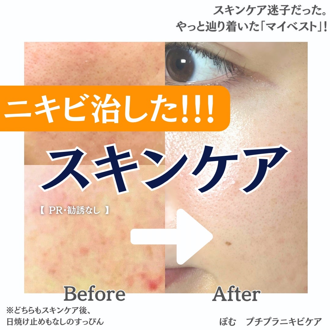 バランシングフェイスオイル ラベンダー/ゼラニウム/MARKS&WEB/ブースター・導入液を使ったクチコミ(1枚目)