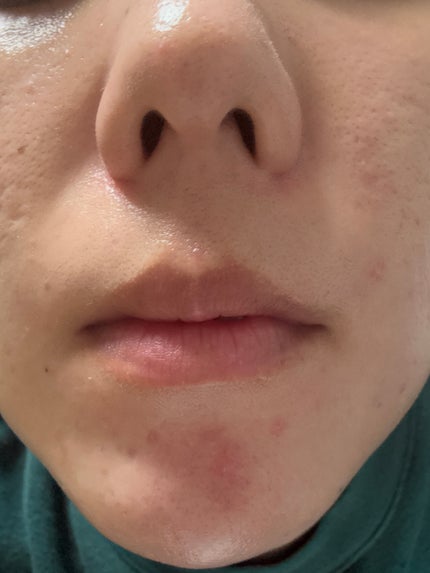 を使ったクチコミ(2枚目)