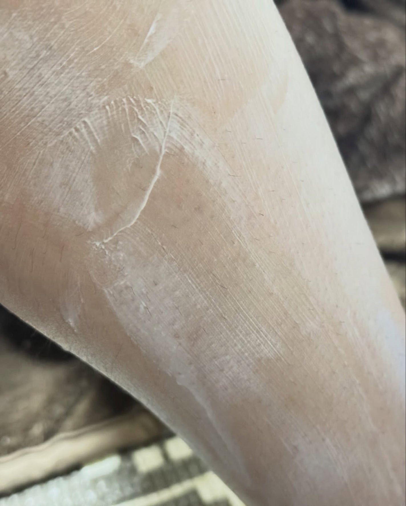 パイナップル豆乳除毛クリーム/鈴木ハーブ研究所/除毛クリームを使ったクチコミ(3枚目)