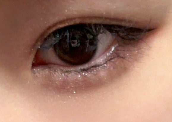 オリシキ アイリッドスキンフィルム EX/D-UP/二重まぶた用アイテムを使ったクチコミ(1枚目)