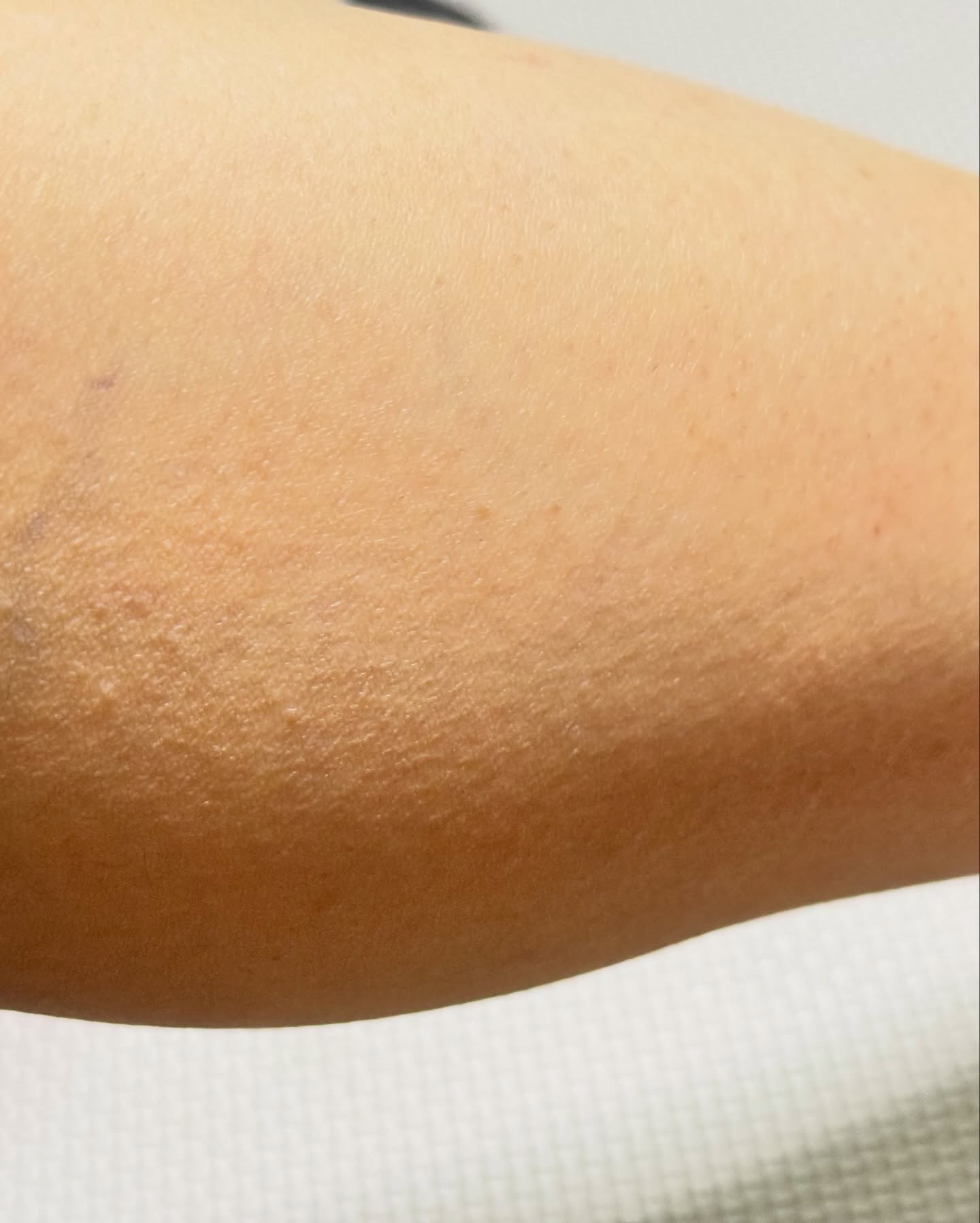 パイナップル豆乳ローションプレミアム/鈴木ハーブ研究所/ボディローションを使ったクチコミ（3枚目）