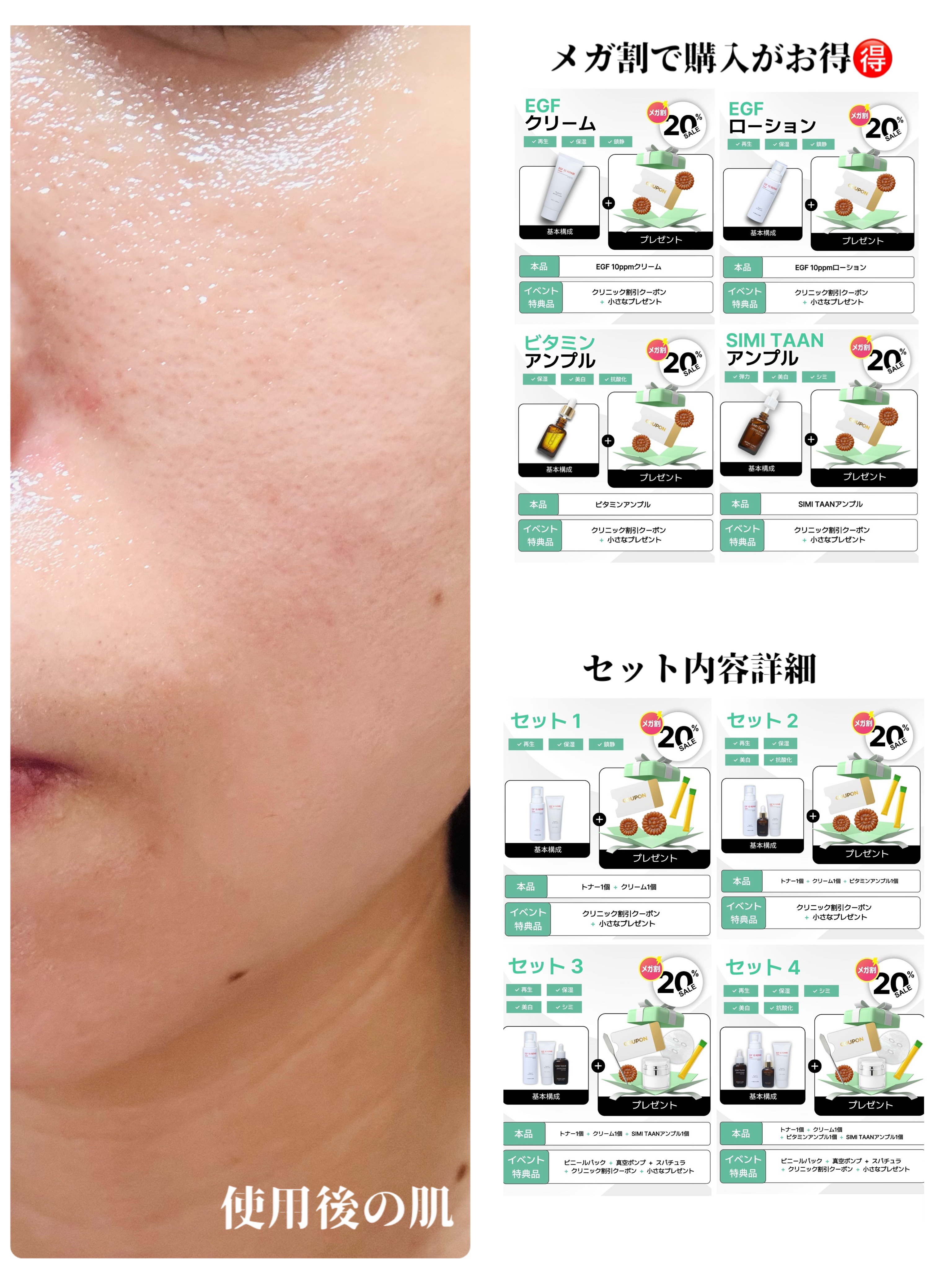 EGFクリーム/Mitam Clinic/フェイスクリームを使ったクチコミ（3枚目）