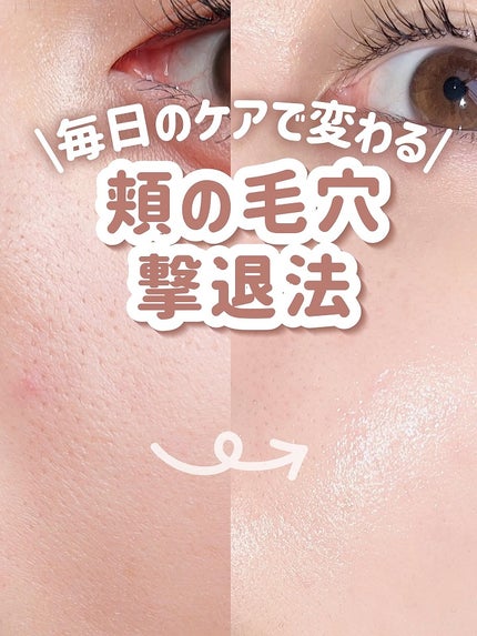 アネトス バランシング トリートメントクリーム/Anetos/フェイスクリームを使ったクチコミ(1枚目)