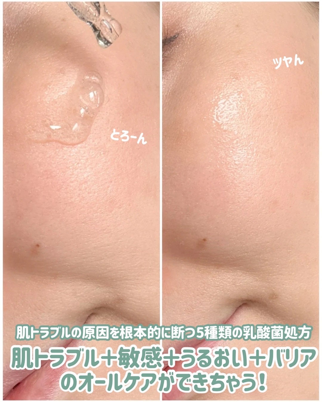 Riho | 集英社MAQUIAエキスパート on LIPS 「「EIOM(イオム)」って知ってる?!🔍乳酸菌由来の成分を使っ..」(6枚目)