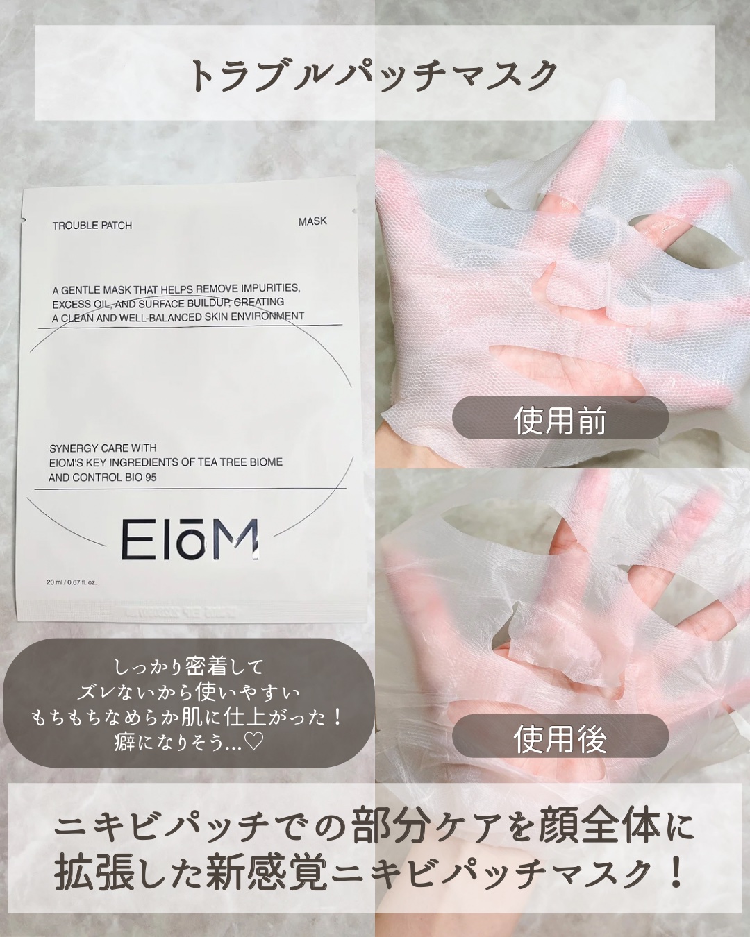 トラブルターゲティングセラム/EIOM/美容液を使ったクチコミ（3枚目）