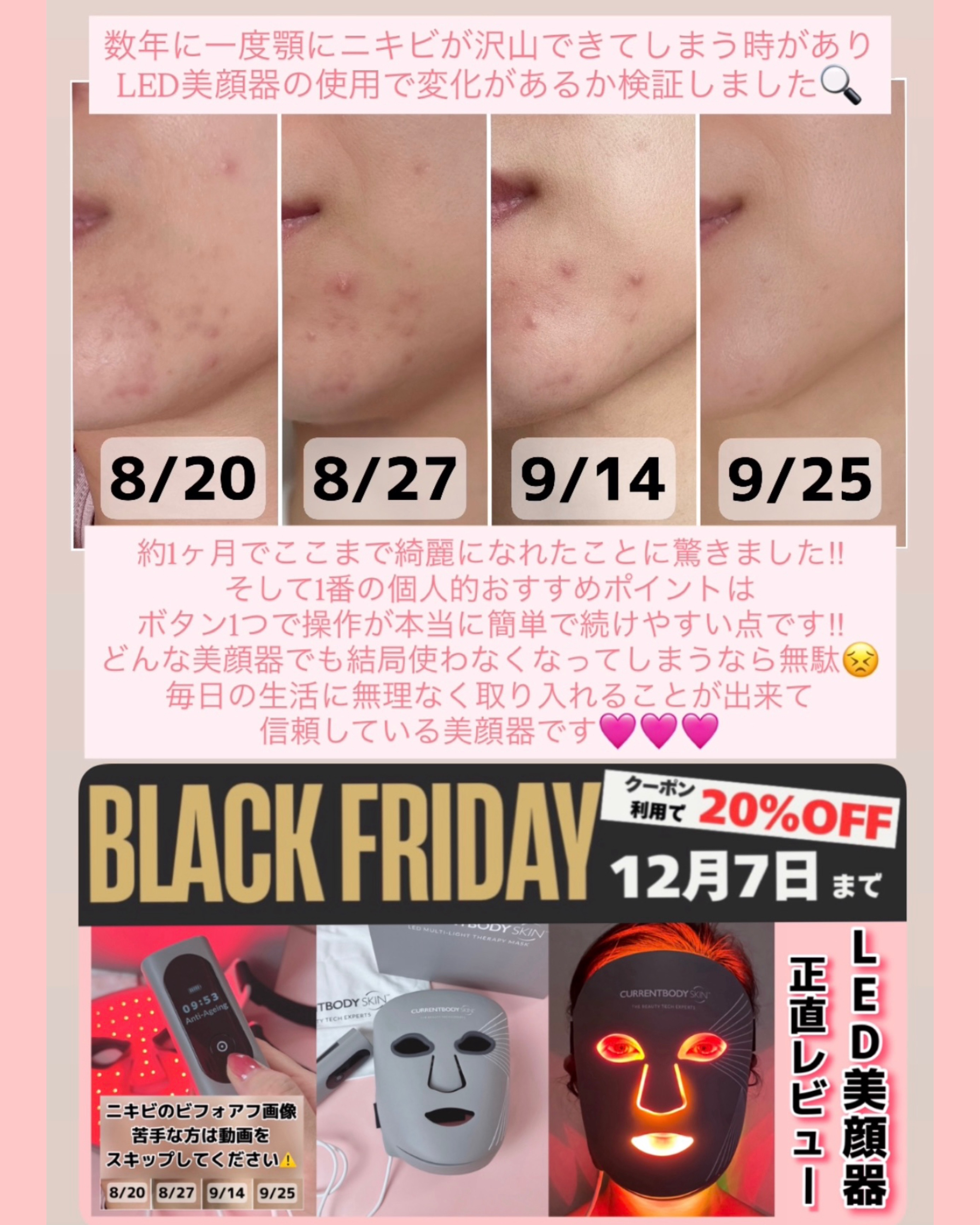 LEDマルチライトマスク/CurrentBody/美顔器・マッサージを使ったクチコミ（1枚目）