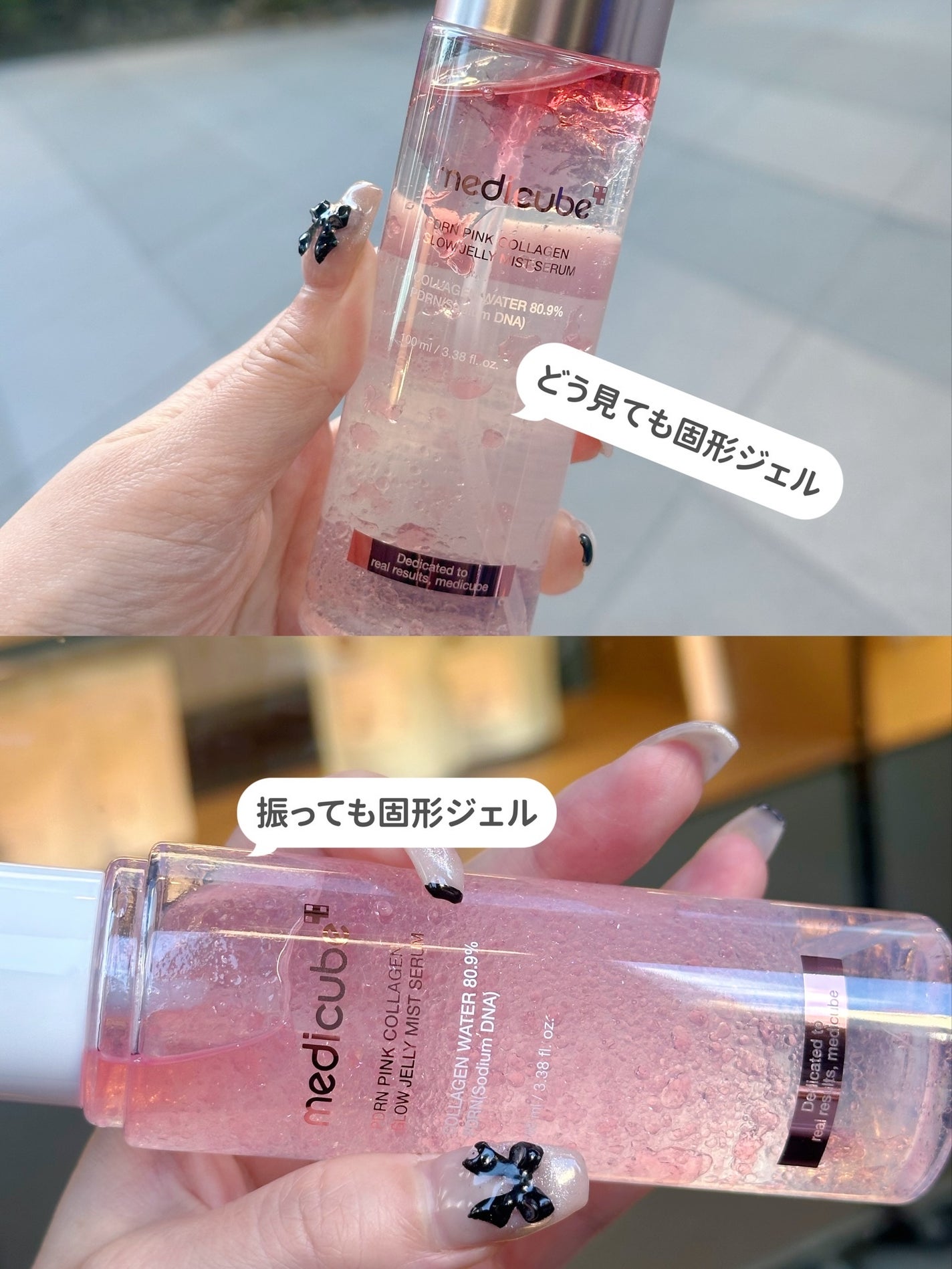 ð¡ã¡ããâ¡ãã©ãã100 on LIPS ãä»æå€§æ³šç®ã®medicubeã®ãŒãªãŒã»ã©ã ãã¹ãâšâ¡èŠãç®ã¯ã·..ãïŒ2æç®ïŒ