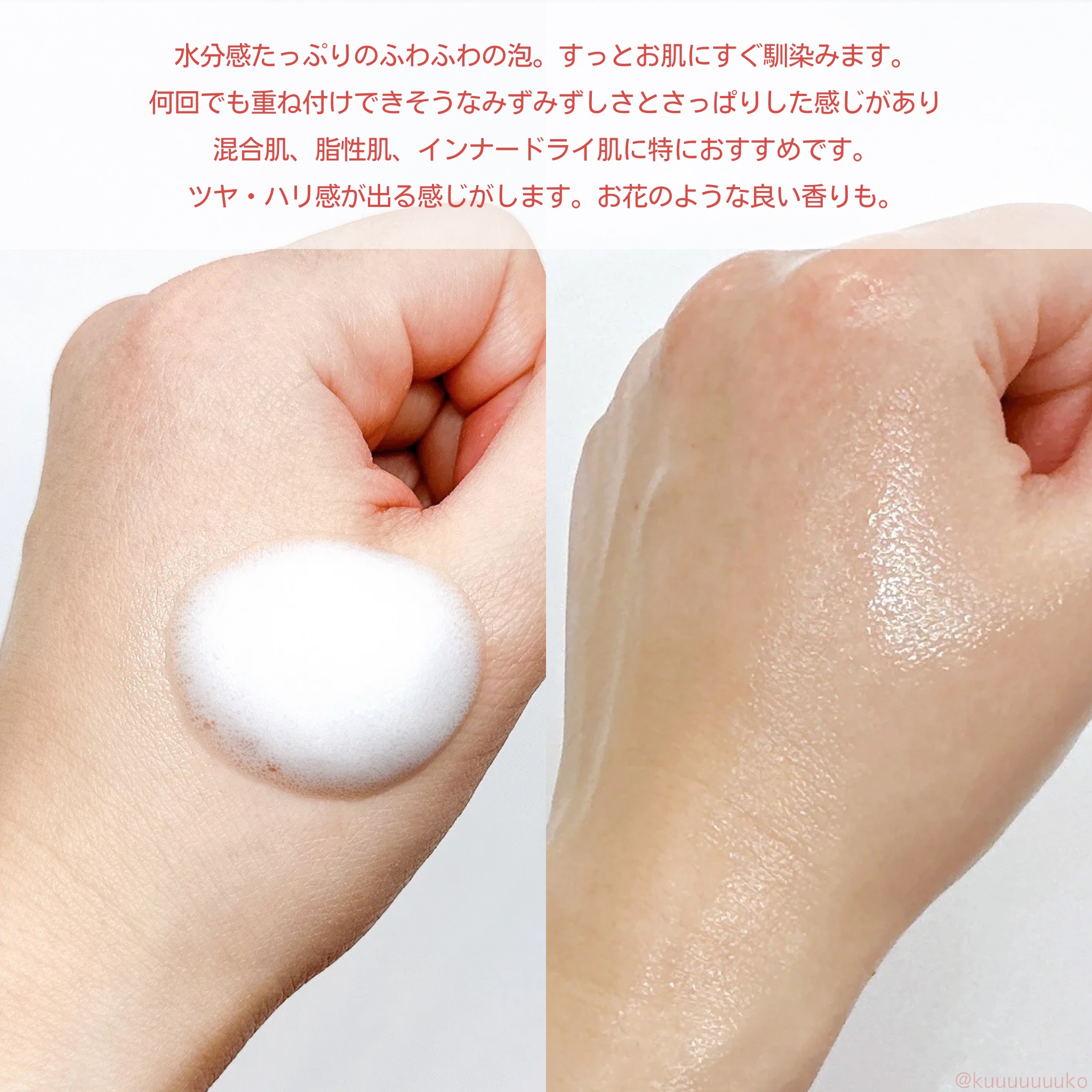 PDRNコラーゲンバブルセラム/CELORABY/美容液を使ったクチコミ（3枚目）