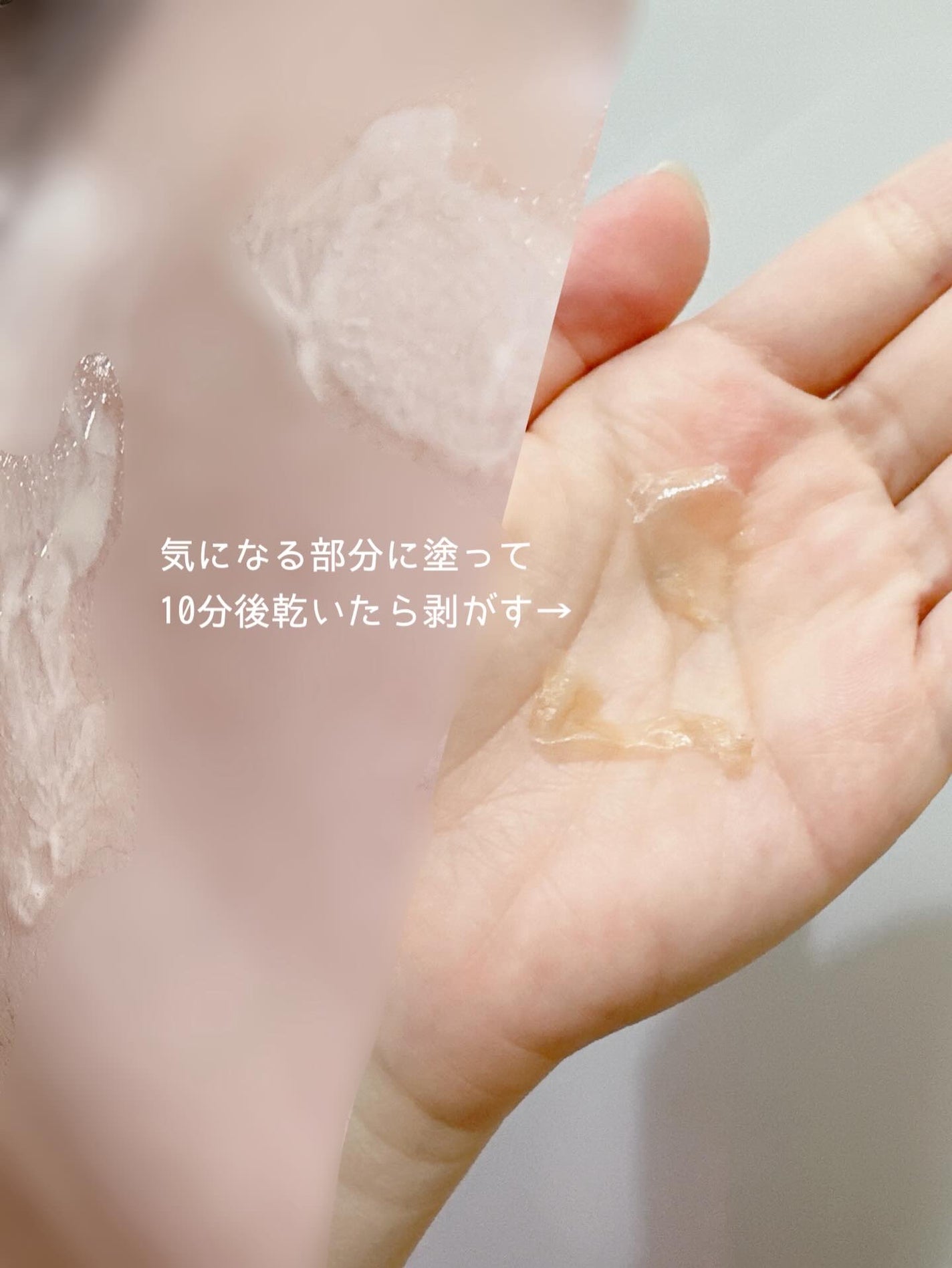 レディブラン 薬用美白シミキールパックC/シーヴァ/ピーリングを使ったクチコミ(2枚目)