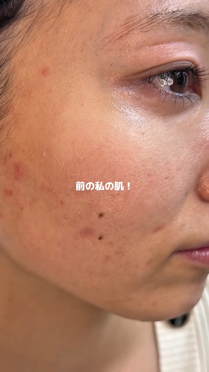 アネトス バランシング トリートメントクリーム/Anetos/フェイスクリームを使ったクチコミ（2枚目）