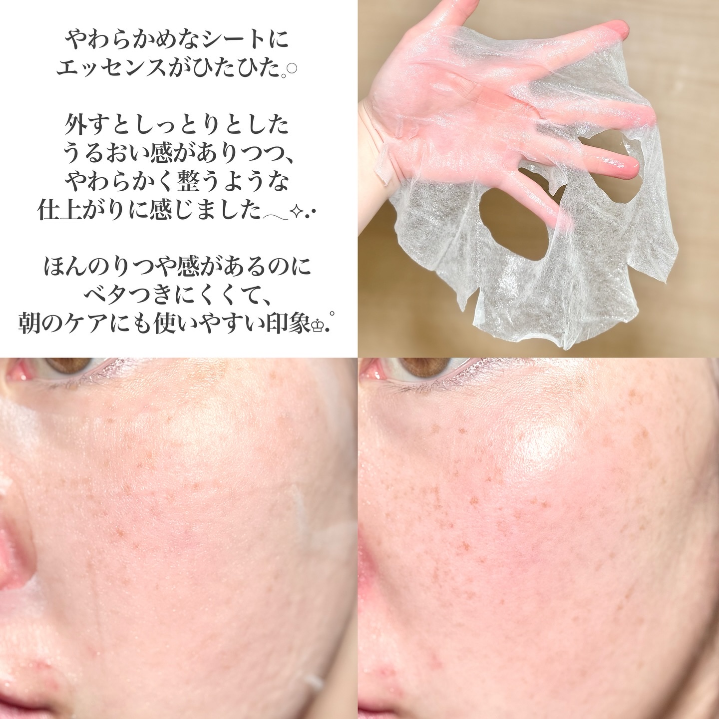 PDRN リフティングマスク/MEDIHEAL/シートマスク・パックを使ったクチコミ（3枚目）