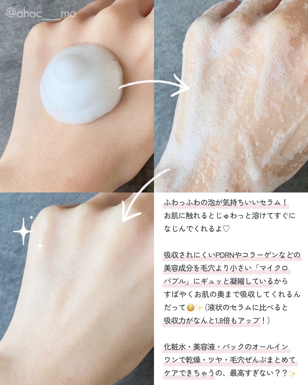 PDRNコラーゲンバブルセラム/CELORABY/美容液を使ったクチコミ（3枚目）