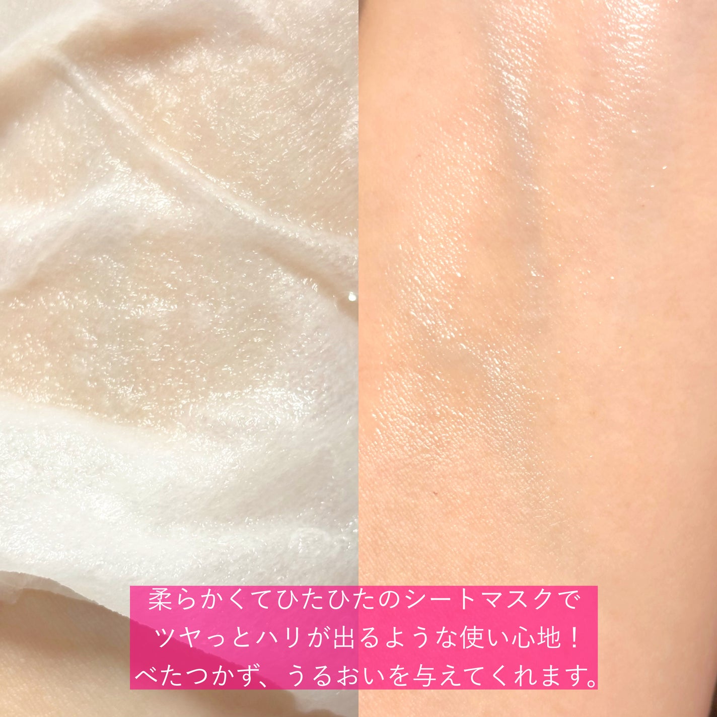 PDRN リフティングマスク/MEDIHEAL/シートマスク・パックを使ったクチコミ(5枚目)