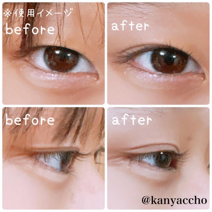 オリシキ アイリッドスキンフィルム EX/D-UP/二重まぶた用アイテムを使ったクチコミ(3枚目)