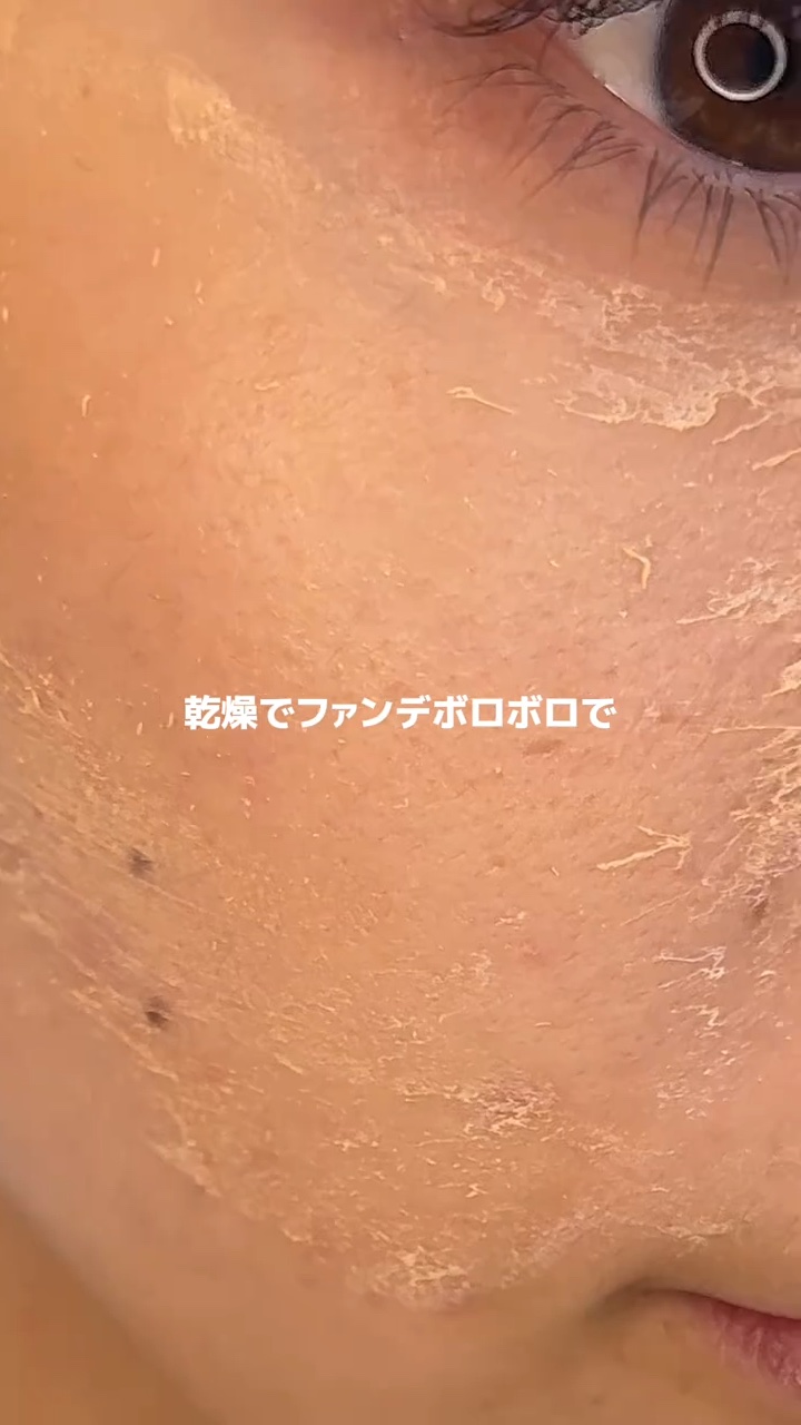 アネトス バランシング トリートメントクリーム/Anetos/フェイスクリームを使ったクチコミ（3枚目）