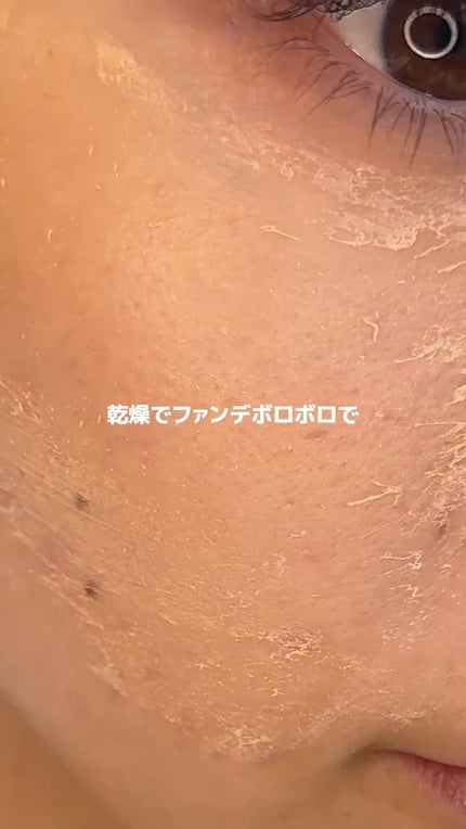 アネトス バランシング トリートメントクリーム/Anetos/フェイスクリームを使ったクチコミ(3枚目)