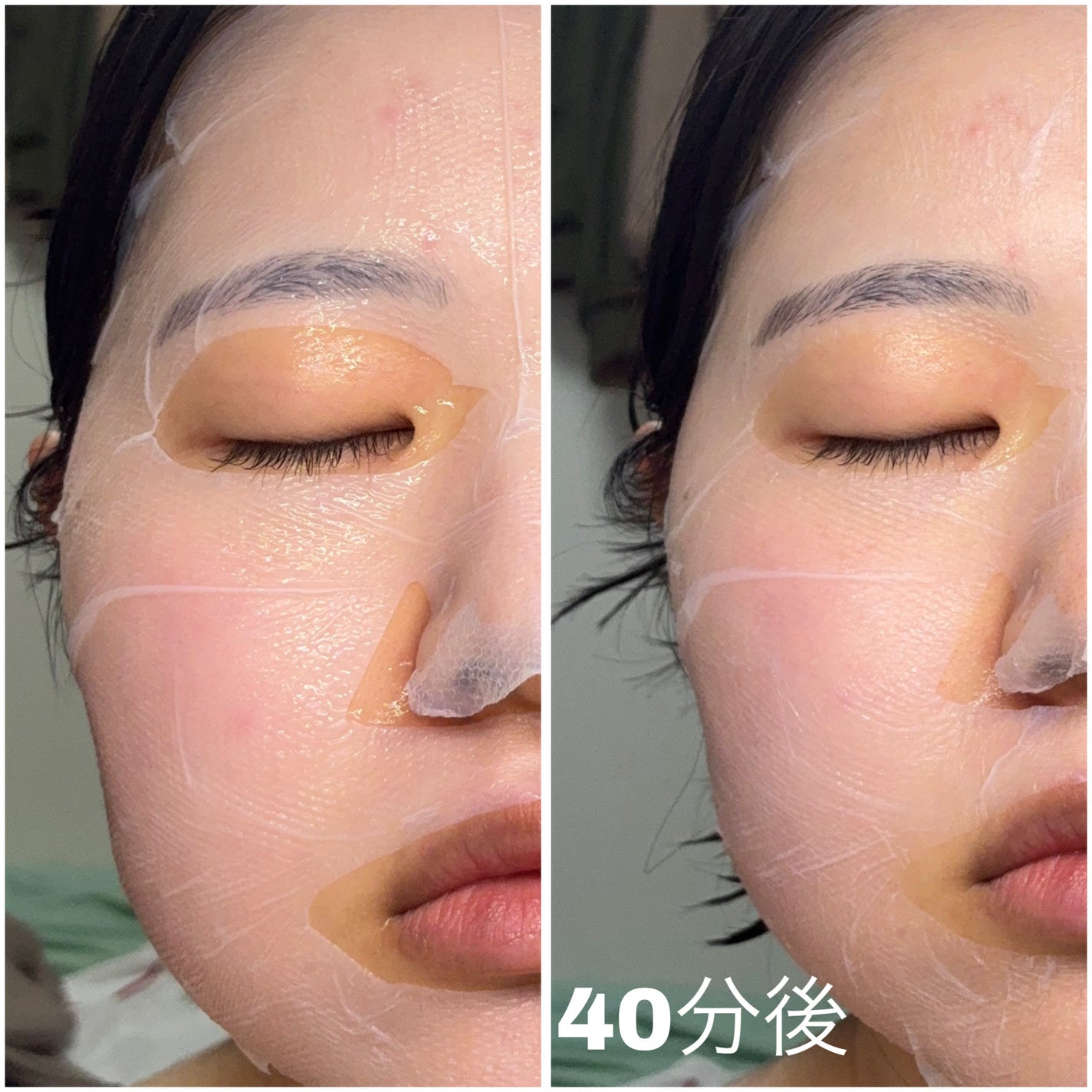 トラブルパッチマスク/EIOM/その他スキンケアを使ったクチコミ(2枚目)