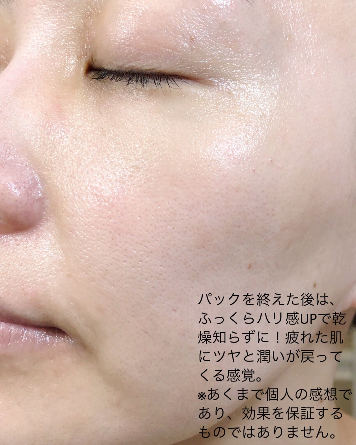 EGFクリーム/Mitam Clinic/フェイスクリームを使ったクチコミ(4枚目)