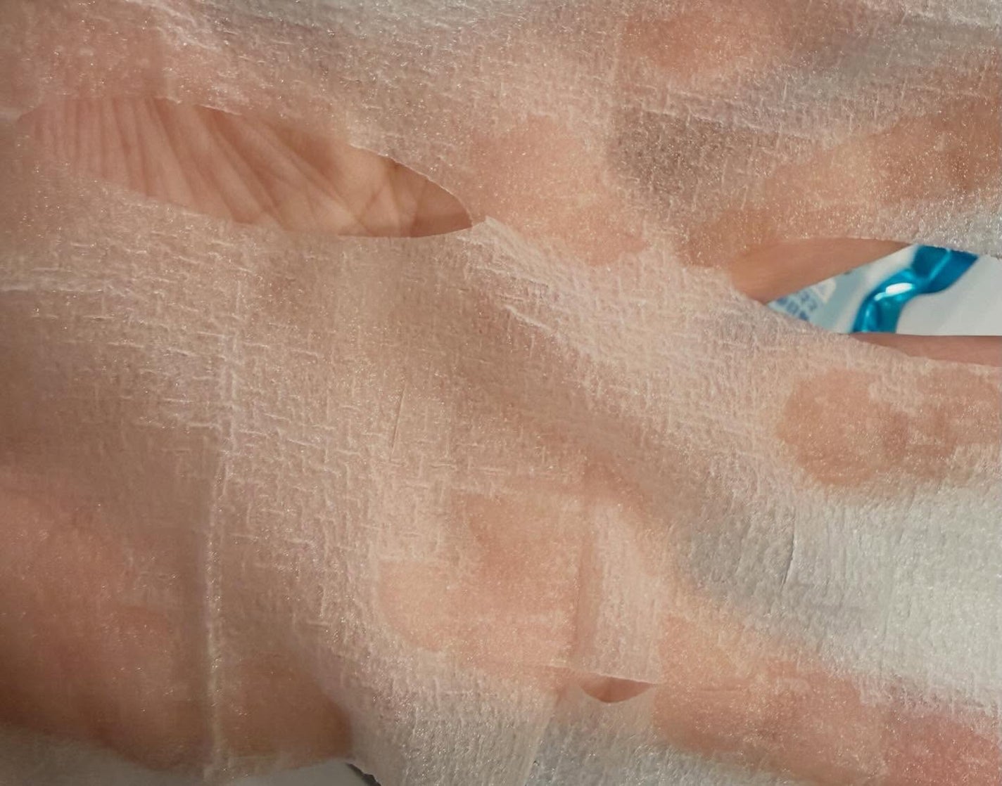 アゼライン酸CICAケアマスク/クリアターン/シートマスク・パックを使ったクチコミ(3枚目)