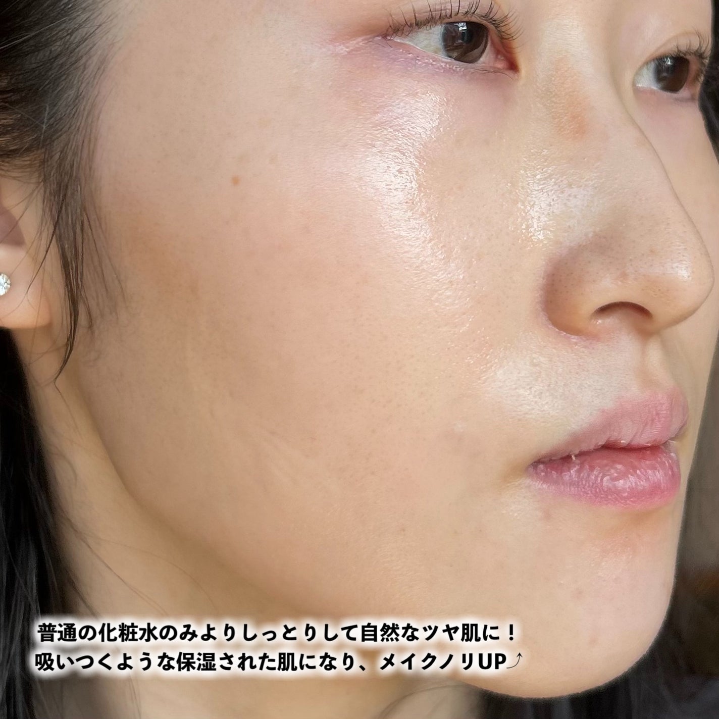 オングリディエンツ スキンバリアカーミングローション EX/Ongredients/乳液を使ったクチコミ(5枚目)