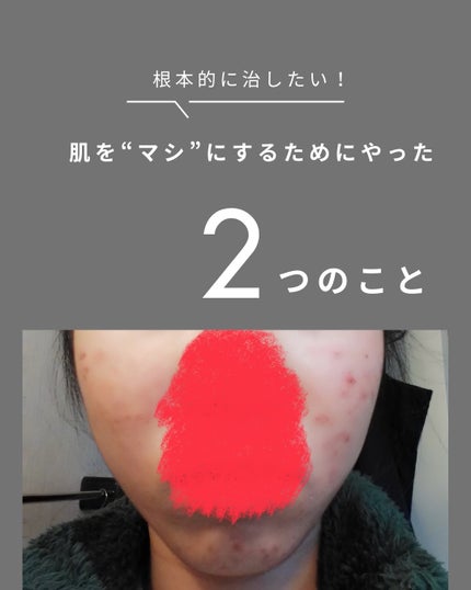 を使ったクチコミ(1枚目)