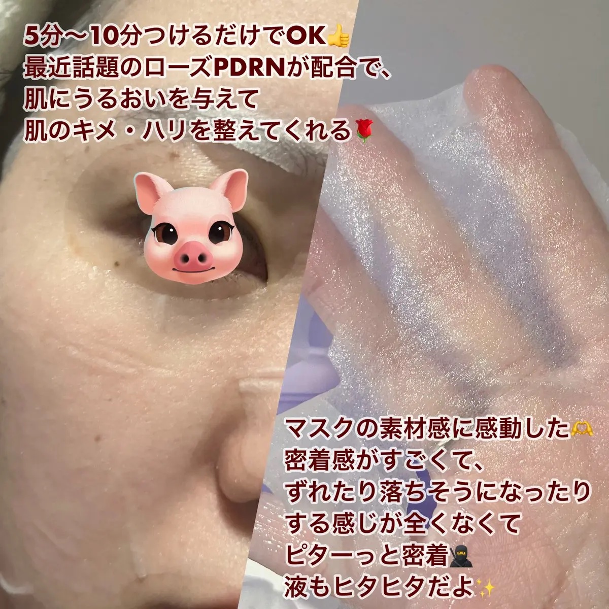 PDRN リフティングマスク/MEDIHEAL/シートマスク・パックを使ったクチコミ（3枚目）