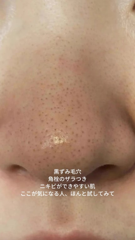 アネトス マイルド フェイシャル クレンザー/Anetos/洗顔フォームを使ったクチコミ(3枚目)