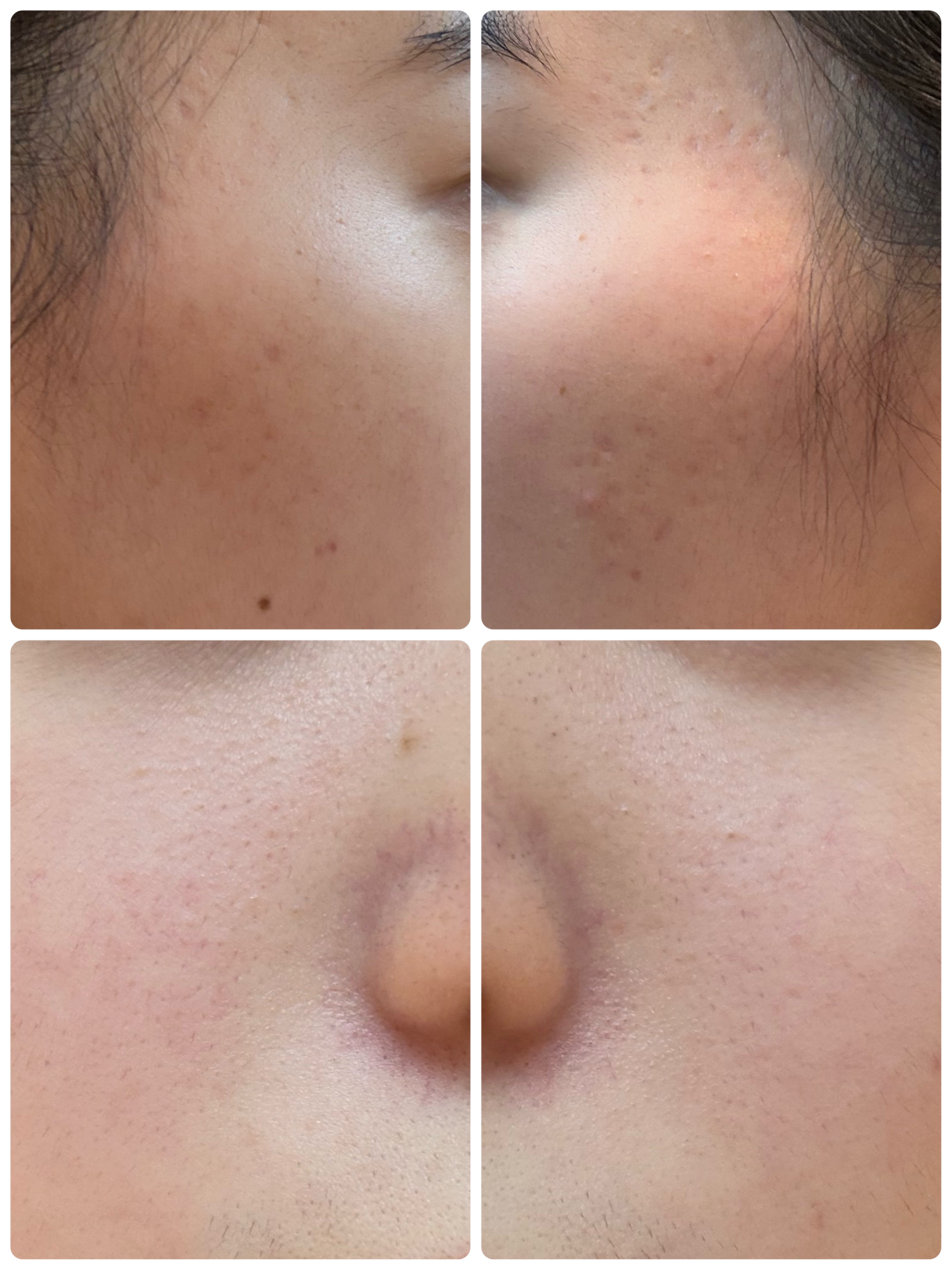 モーニングジェルウォッシュ/ビトレスキン/その他洗顔料を使ったクチコミ（2枚目）