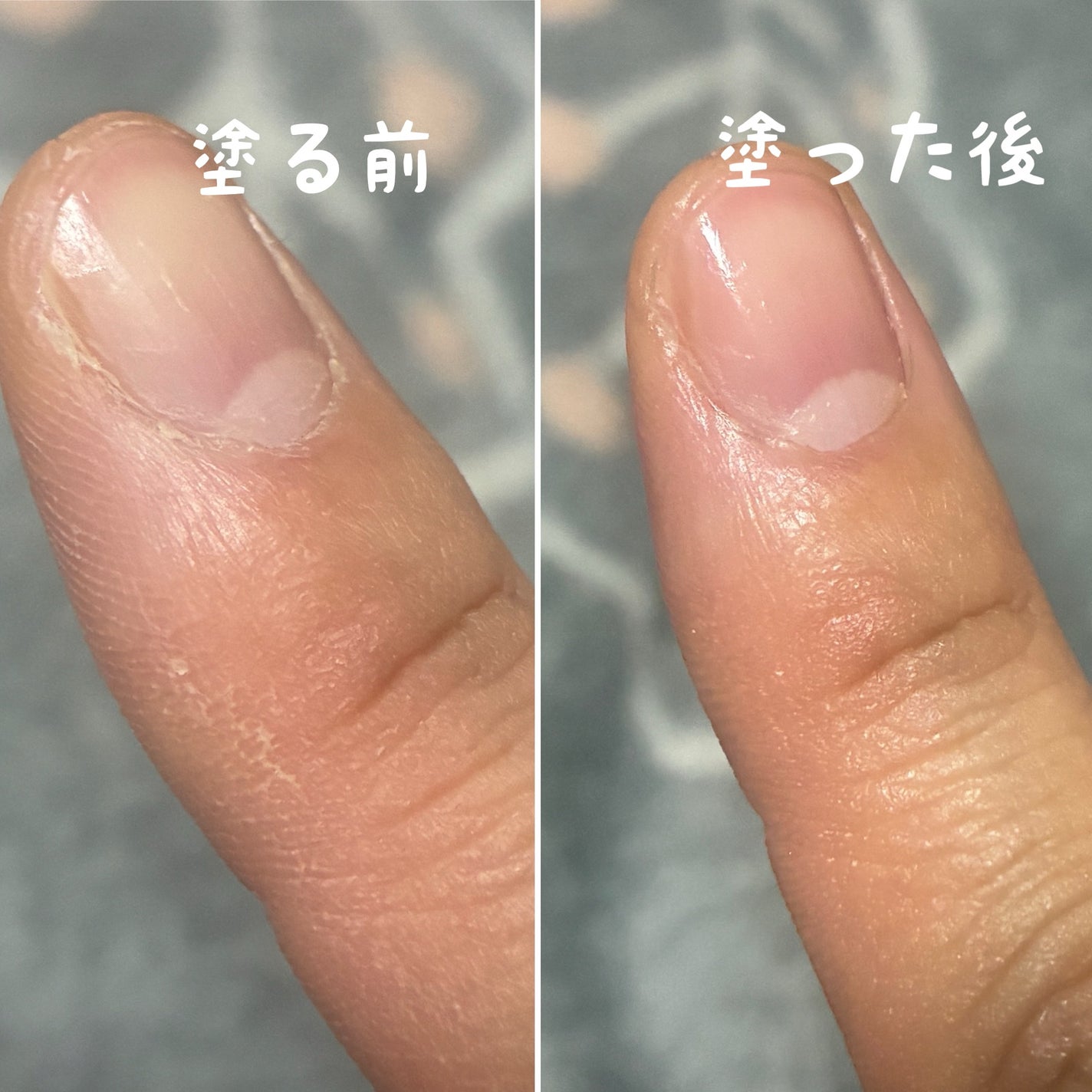 さき on LIPS 「最近、爪の周りがガスガスするので、&SH(アンドエスエイチ)さ..」(3枚目)