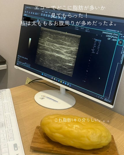 ðððð€ËË on LIPS ãèèªãæ°ã«ãªããªãã»ã»ã»ïŒéåœã®ãèèªã±ã¢ãã«ç¹åãããµã³ãµ..ãïŒ4æç®ïŒ