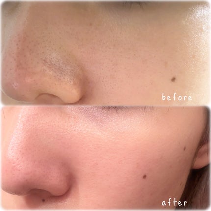 リードルショット100/VT/美容液を使ったクチコミ(4枚目)