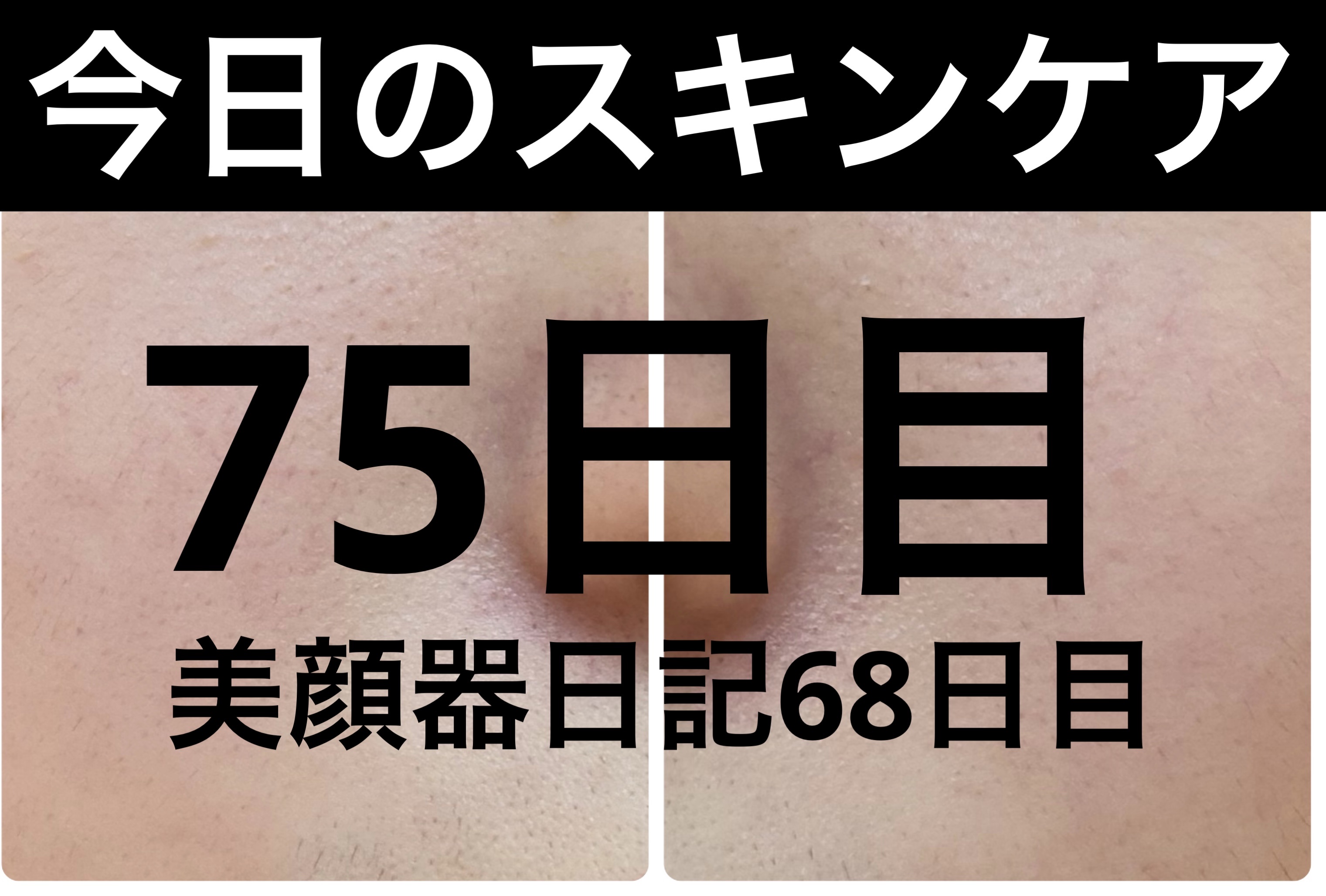 モーニングジェルウォッシュ/ビトレスキン/その他洗顔料を使ったクチコミ（1枚目）