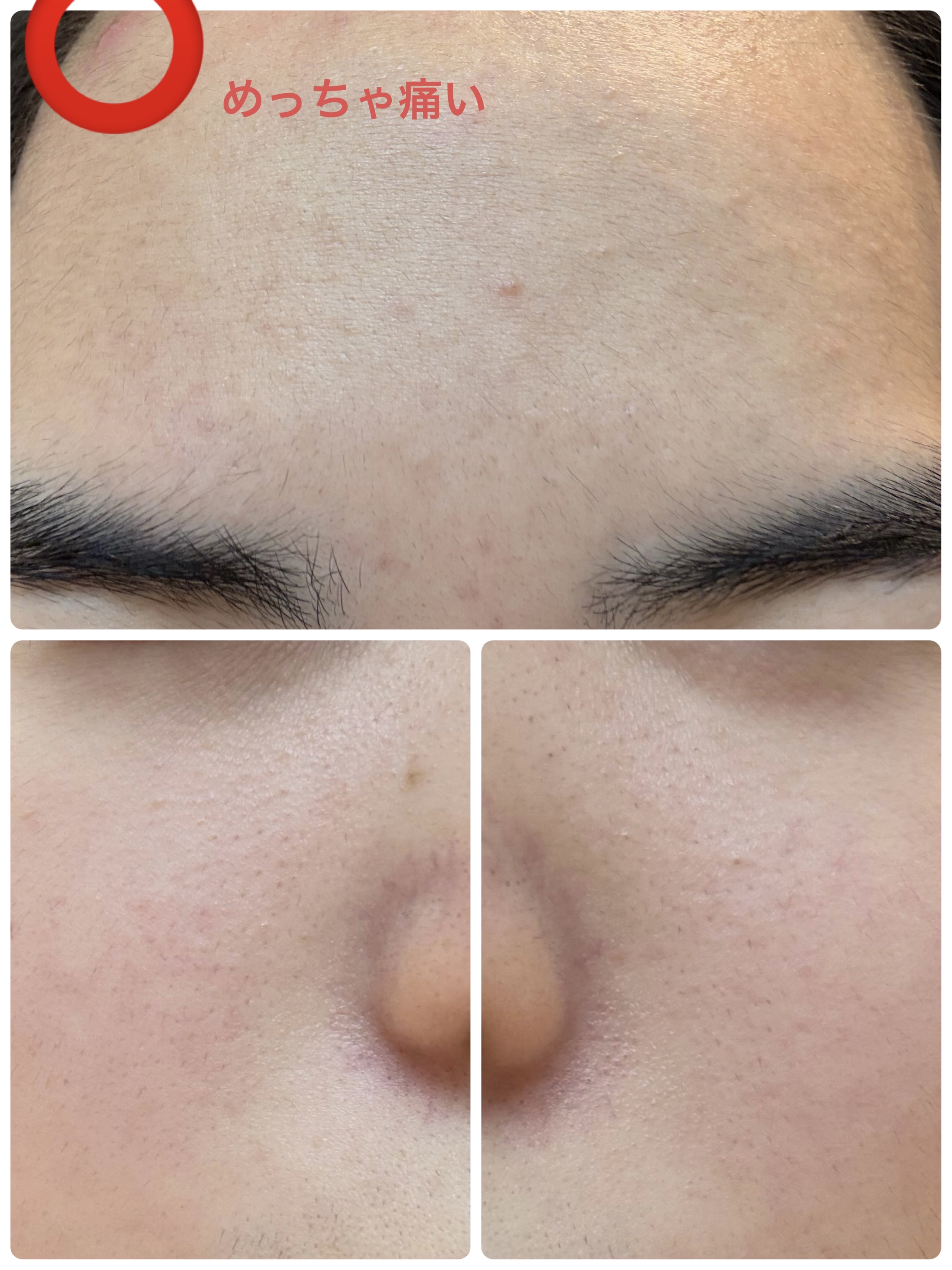 モーニングジェルウォッシュ/ビトレスキン/その他洗顔料を使ったクチコミ（3枚目）