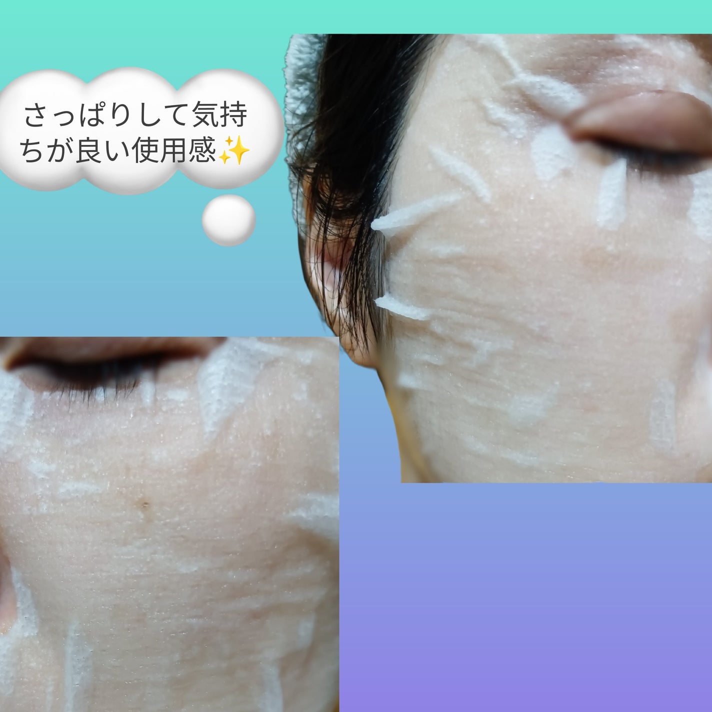 アゼライン酸CICAケアマスク/クリアターン/シートマスク・パックを使ったクチコミ(5枚目)