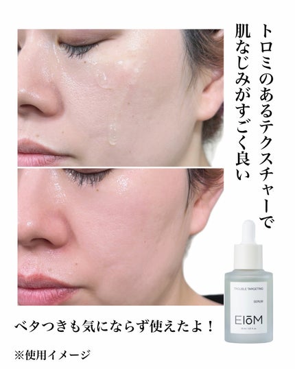 natsumi on LIPS 「毛穴・皮脂ケア/皮脂コントロールにはこれ/日本初上陸の韓国スキ..」(4枚目)