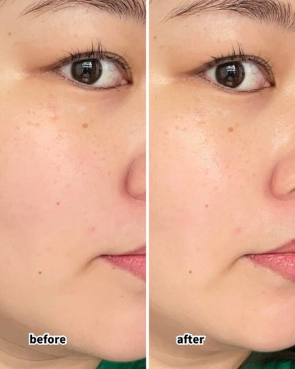 デイスキンコンフォート/excel/フェイスクリームを使ったクチコミ(4枚目)